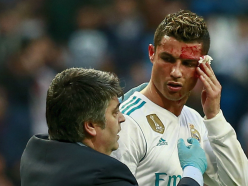 Ronaldo suffers nasty bloodied cut to the head & uses physio