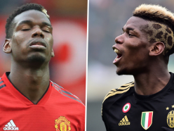 Why Pogba has struggled to reach Juventus heights at Man Utd